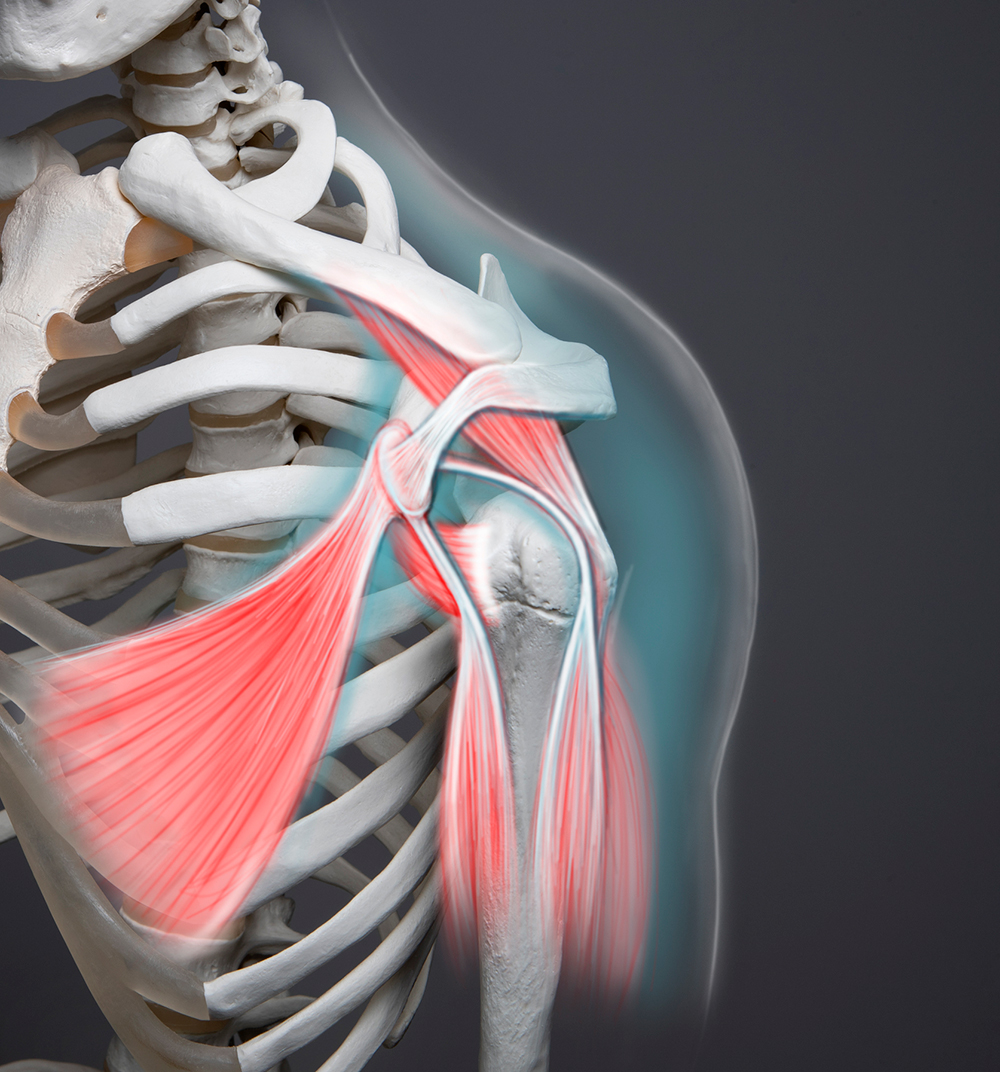 Image showing shoulder pain