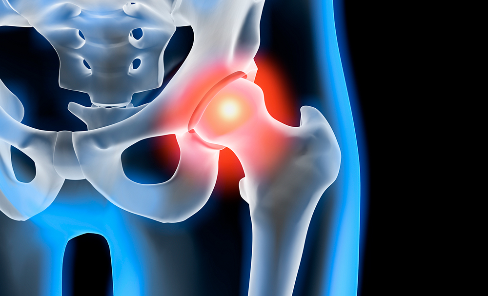 Image indicating pain in the hip